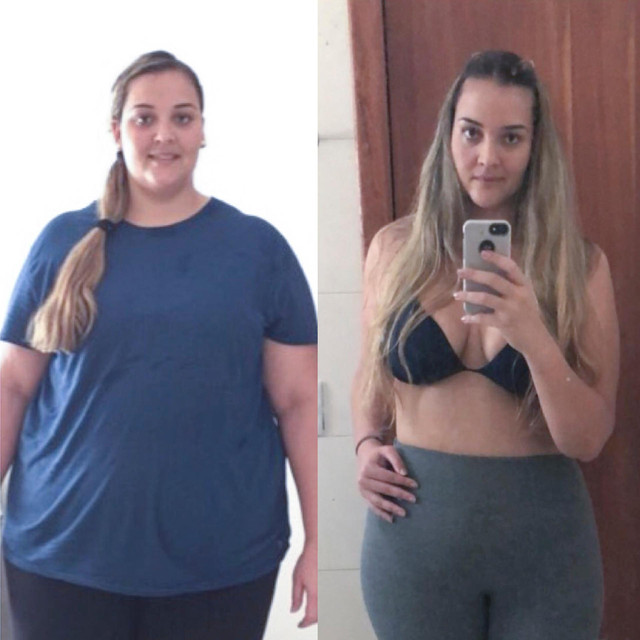 Merrci before and after Gelatide